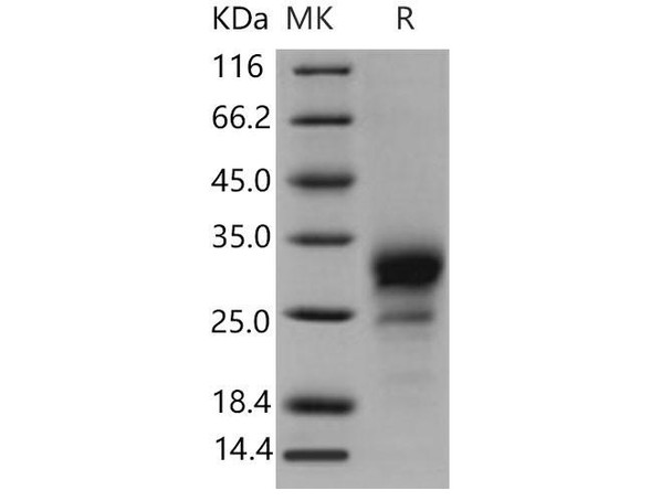 Mouse TNFRSF19/TROY Recombinant Protein (RPES3612)