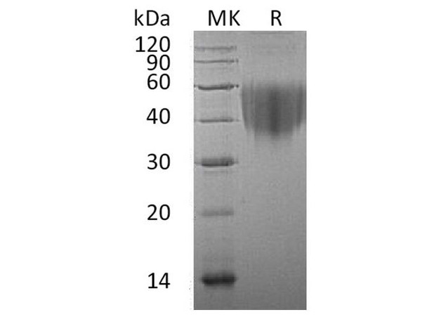 Human CD80/B7 Recombinant Protein (RPES3616)