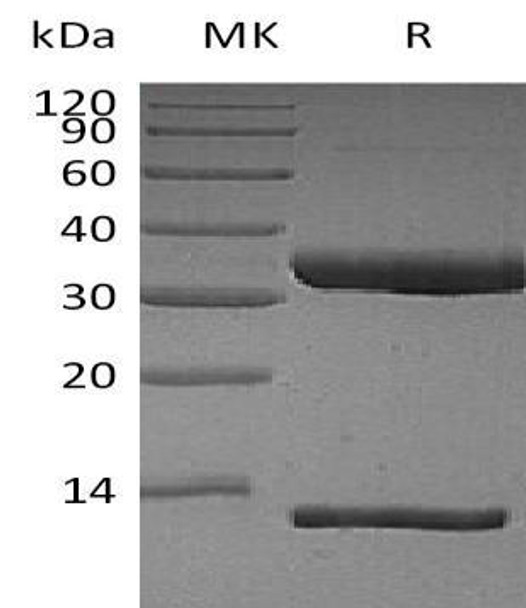 Human FcRn & B2M Heterodimer Recombinant Protein (RPES3629)