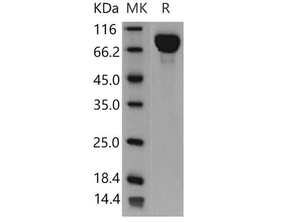 Mouse IL6ST/CD130 Recombinant Protein (RPES3633)