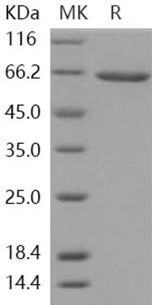 Human XRP2/RP2 Recombinant Protein (RPES3642)