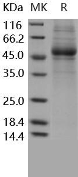 Human IL5RA/IL-5 R Alpha Recombinant Protein (RPES3643)