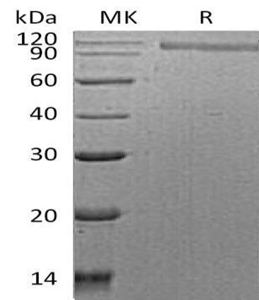 Human HER2/ErbB2 Recombinant Protein (RPES3652)