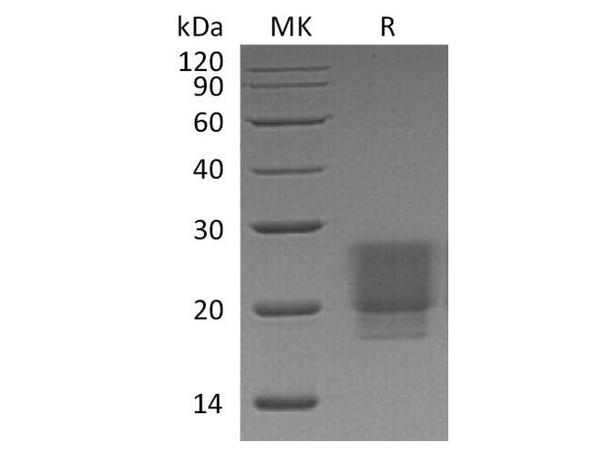 Human/Mouse/Rat Irisin/FNDC5 Recombinant Protein (RPES3660)