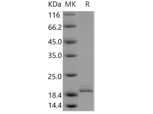 Human PPP3R1 Recombinant Protein (RPES3670)