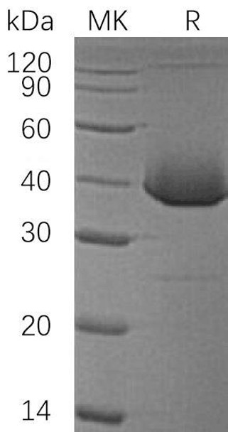 Human LDH-B/LDHB Recombinant Protein (RPES3674)