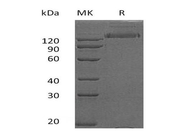 Human HER2/ErbB2 Recombinant Protein (RPES3675)