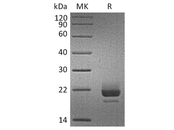 Human CD40L/TNFSF5 Recombinant Protein (RPES3683)