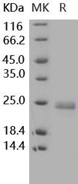 Human TNFSF14/LIGHT Recombinant Protein (RPES3688)