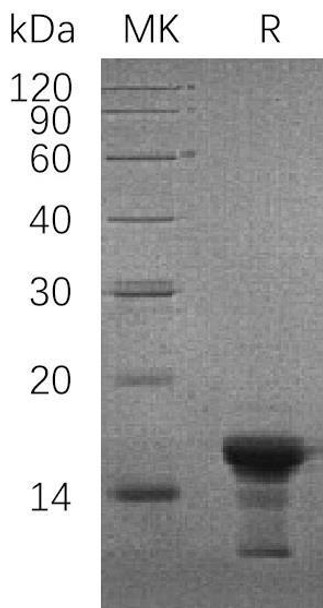Human gamma-Synuclein/SNCG Recombinant Protein (RPES3698)