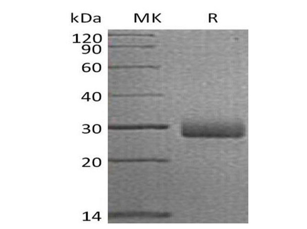 Human Retbindin/RTBDN Recombinant Protein (RPES3761)