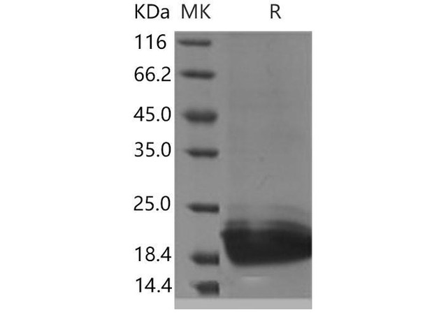 Mouse PGLYRP1/PGRP-S Recombinant Protein (RPES3763)