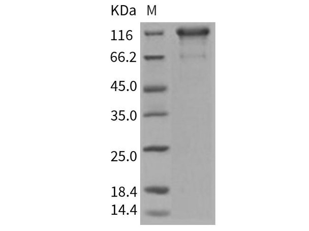 Human PDGFRa/CD140a Recombinant Protein (RPES3778)