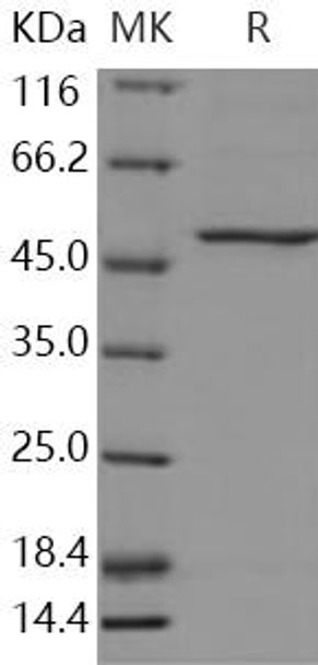 Human PAH/PH Recombinant Protein (RPES3793)