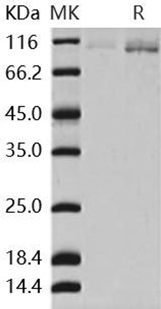 AGO2/Argonaute 2/EIF2C2 Recombinant Protein (RPES3815)
