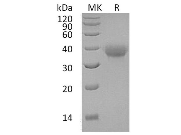 Human OX40/TNFRSF4 Recombinant Protein (RPES3831)