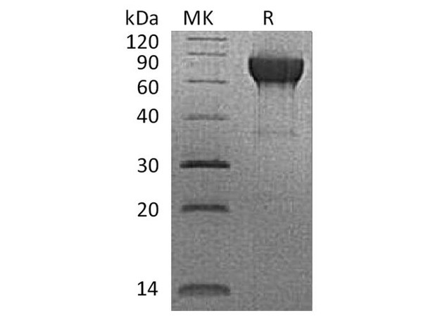 Rhesus macaque CD27/TNFRSF7 Recombinant Protein (RPES3855)