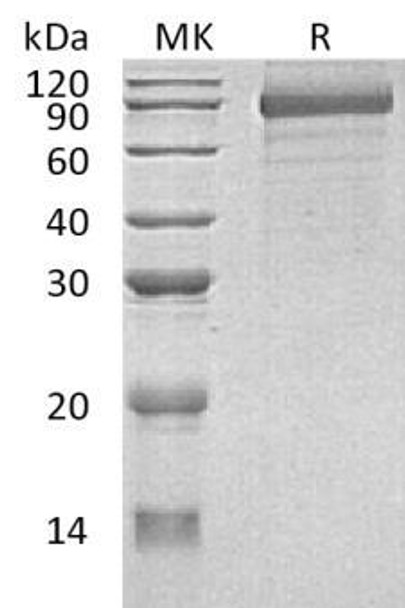 Human Cadherin-8/CDH8 Recombinant Protein (RPES3865)