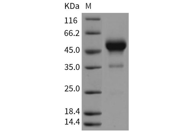Rat Interferon gamma/IFNG Recombinant Protein (RPES3869)