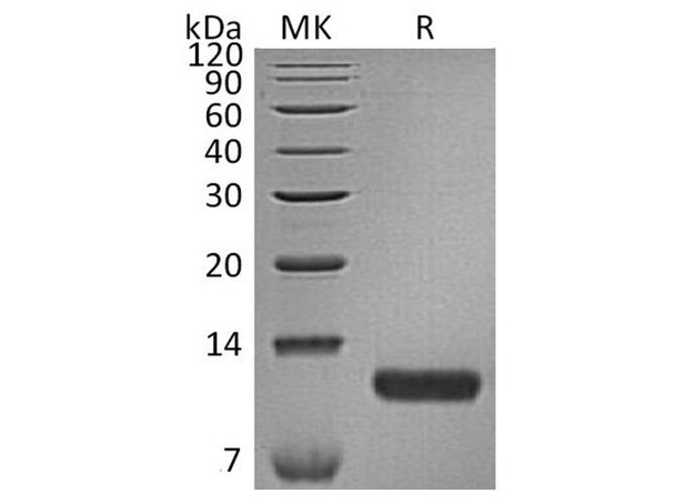 Human CCL17/TARC Recombinant Protein (RPES3877)