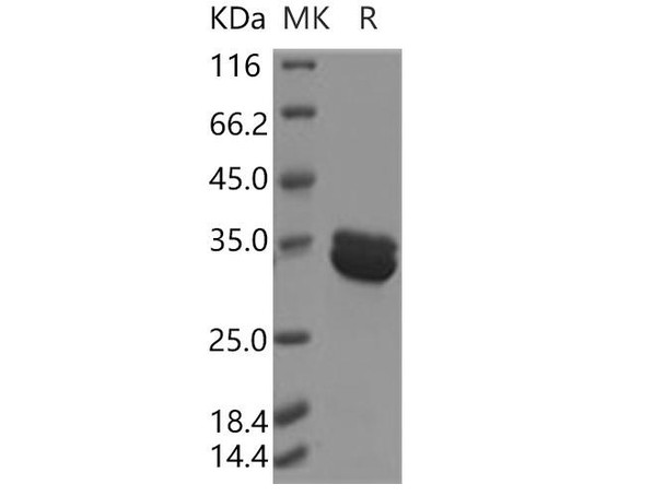 Human Annexin A8/ANXA8 Recombinant Protein (RPES3901)