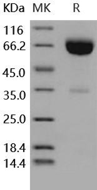 Human IFNAR2/IFNABR Recombinant Protein (RPES3904)