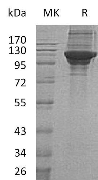 Human KARS Recombinant Protein (RPES3912)