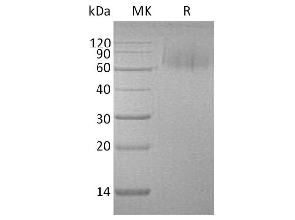 Human MERTK/MER Recombinant Protein (RPES3920)