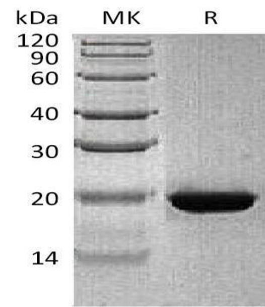 Human RBP4 Recombinant Protein (RPES3926)