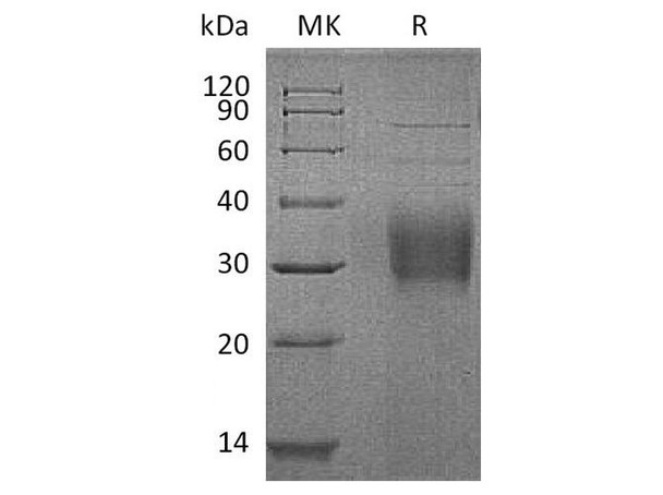 Human TROP2/TACSTD2 Recombinant Protein (RPES3941)