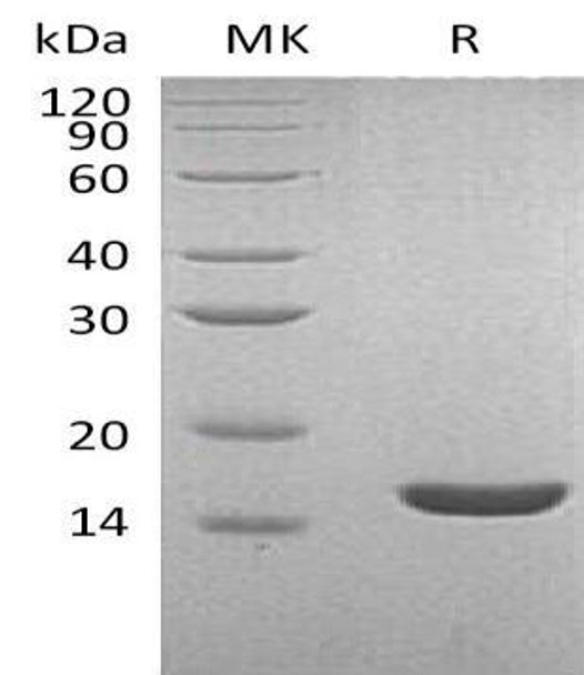 Human Lysozyme C/LYZ Recombinant Protein (RPES3955)