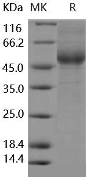 Human IL13RA2/CD213A2 Recombinant Protein (RPES3969)