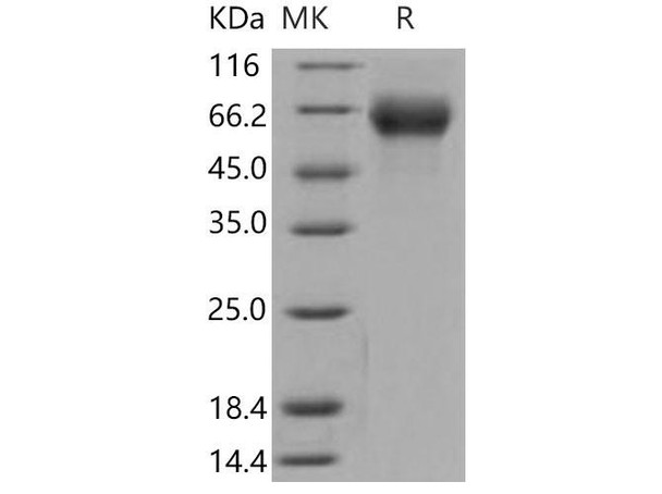 Mouse FGFR4/CD334 Recombinant Protein (RPES3972)