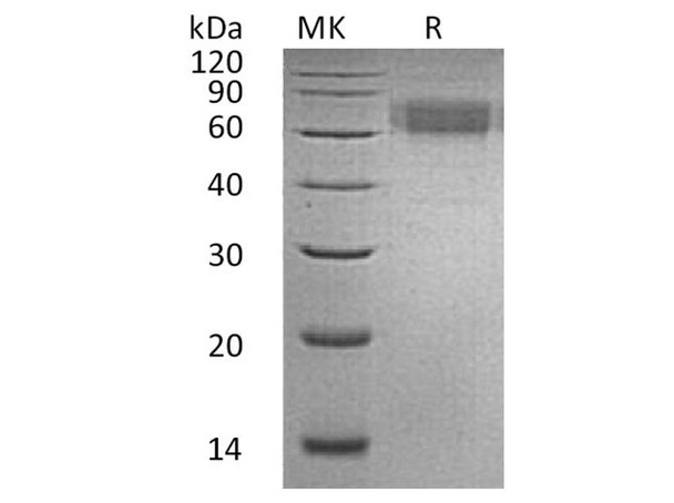 Human IL6RA/CD126 Recombinant Protein (RPES3983)