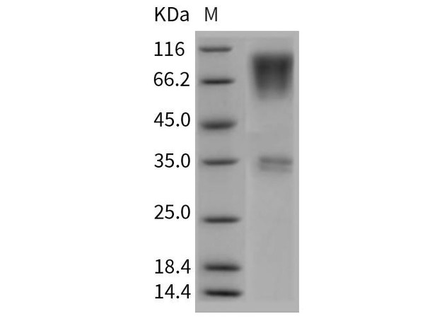 Rat CD164/Endolyn Recombinant Protein (RPES3991)