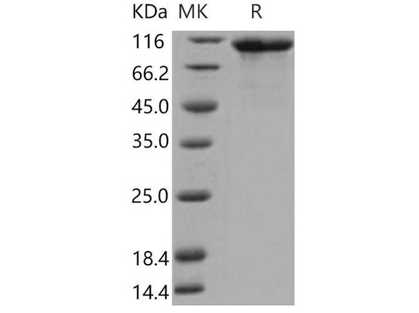 Mouse FGFR4/CD334 Recombinant Protein (RPES3993)