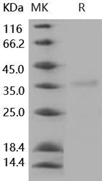 Human Granzyme H Recombinant Protein (RPES4012)