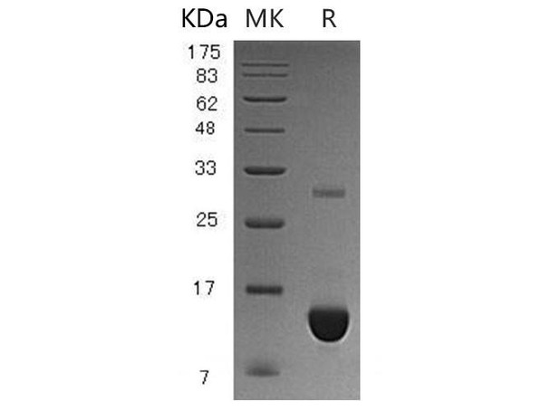 Human S100P/S100E Recombinant Protein (RPES4041)