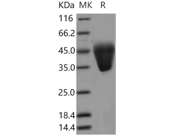 Human KCT2/C5orf15 Recombinant Protein (RPES4077)