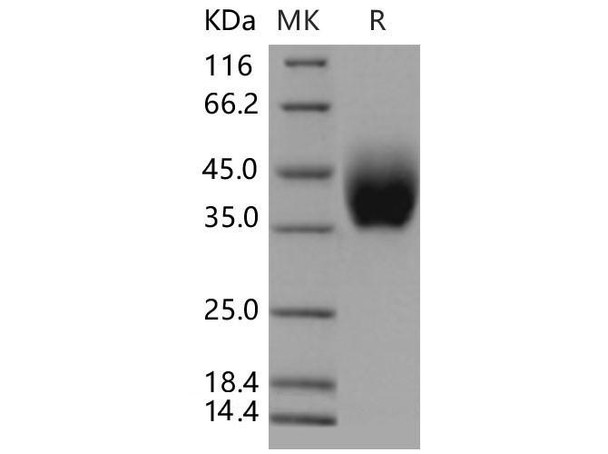 Mouse IL10RB/IL10R2 Recombinant Protein (RPES4106)