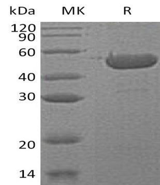 Human Sedoheptulokinase/SHPK Recombinant Protein (RPES4112)