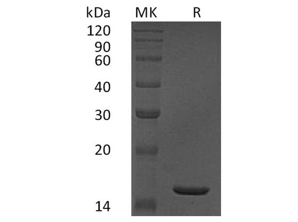 Human TNF-alpha/TNFA Recombinant Protein  (RPES4122)