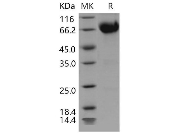 Mouse IL10RB/IL10R2 Recombinant Protein (RPES4130)