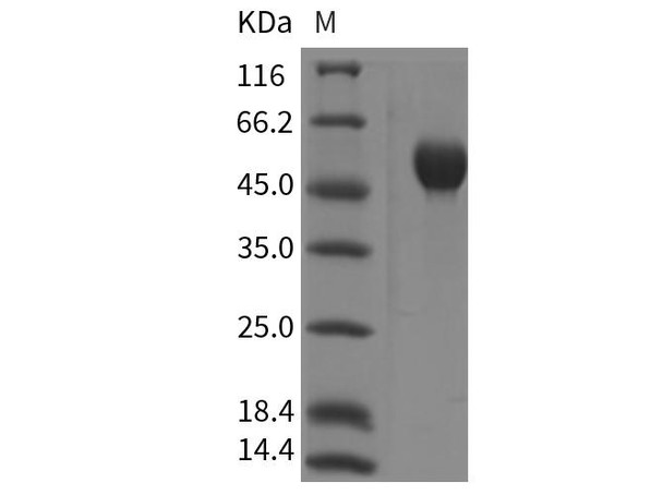 Rat SerpinA1/A1AT Recombinant Protein (RPES4138)