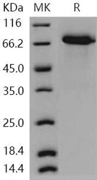 Human WFIKKN2/GASP Recombinant Protein (RPES4149)
