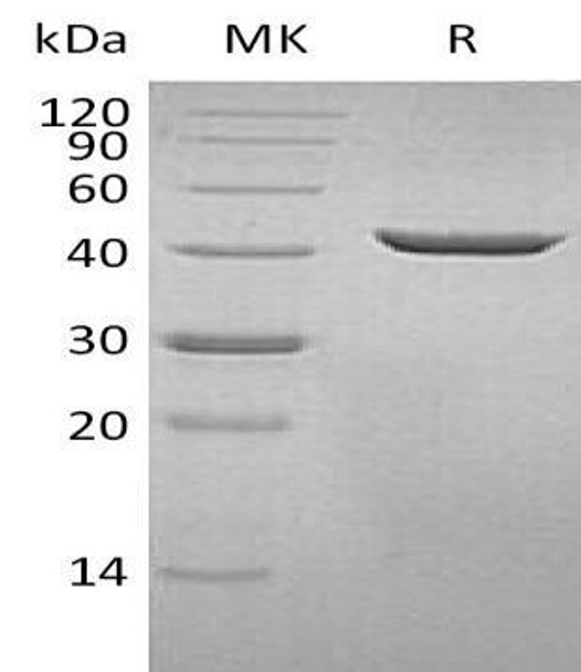 Human SEPHS1 Recombinant Protein (RPES4160)