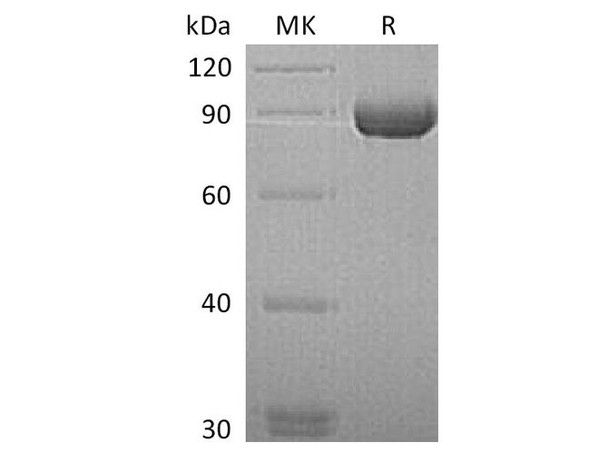 Human MMP-9 Recombinant Protein (RPES4168)