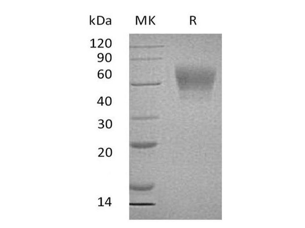 Human TPBG/5T4 Recombinant Protein (RPES4169)