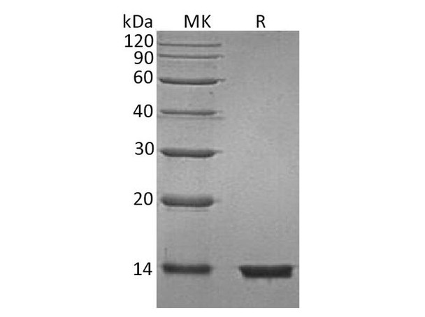 Beta-2-Microglobulin/B2M Recombinant Protein (RPES4170)