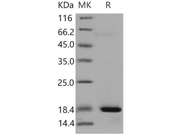 Mouse REG3A/HIP Recombinant Protein (RPES4178)